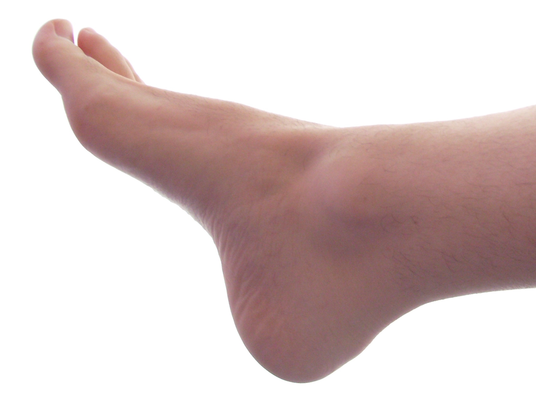Normal foot arch showing the medial longitudinal arch